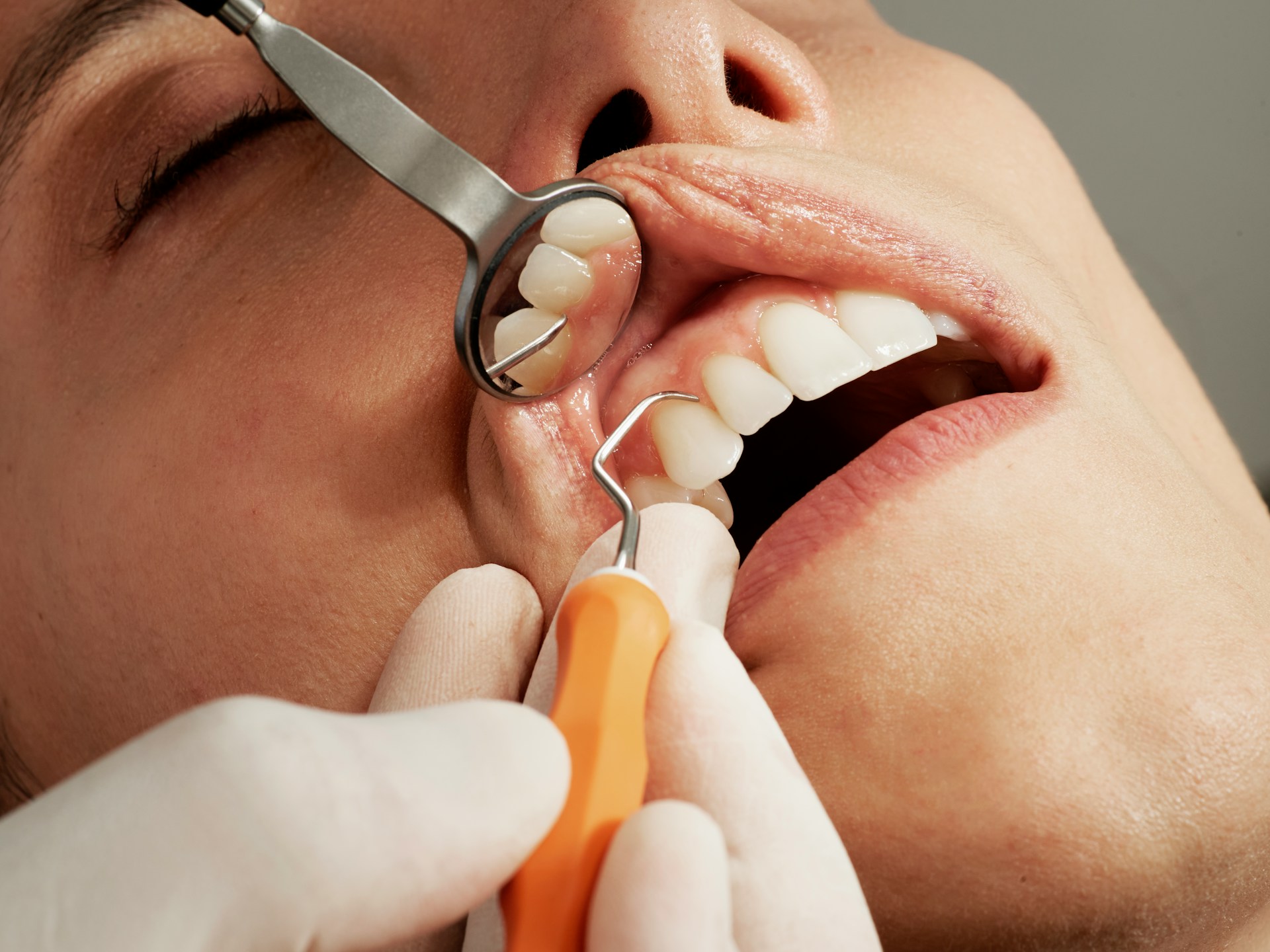 Les coordonnées des dentistes de Quimper sont disponibles sur l’annuaire info-dentistes.fr